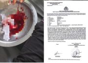 Anggota Keamanan Outsourcing PT Jaya Wira Manggala Diduga Dikeroyok di Areal PTPN IV Tinjowan, Aktivis Soroti Dugaan Aktivitas Ilegal